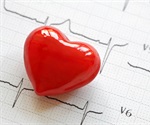 Obesity-related heart disease deaths rise sharply in the U.S. between 1999 and 2020