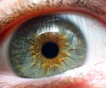 Johns Hopkins study offers new hope for wet AMD patients